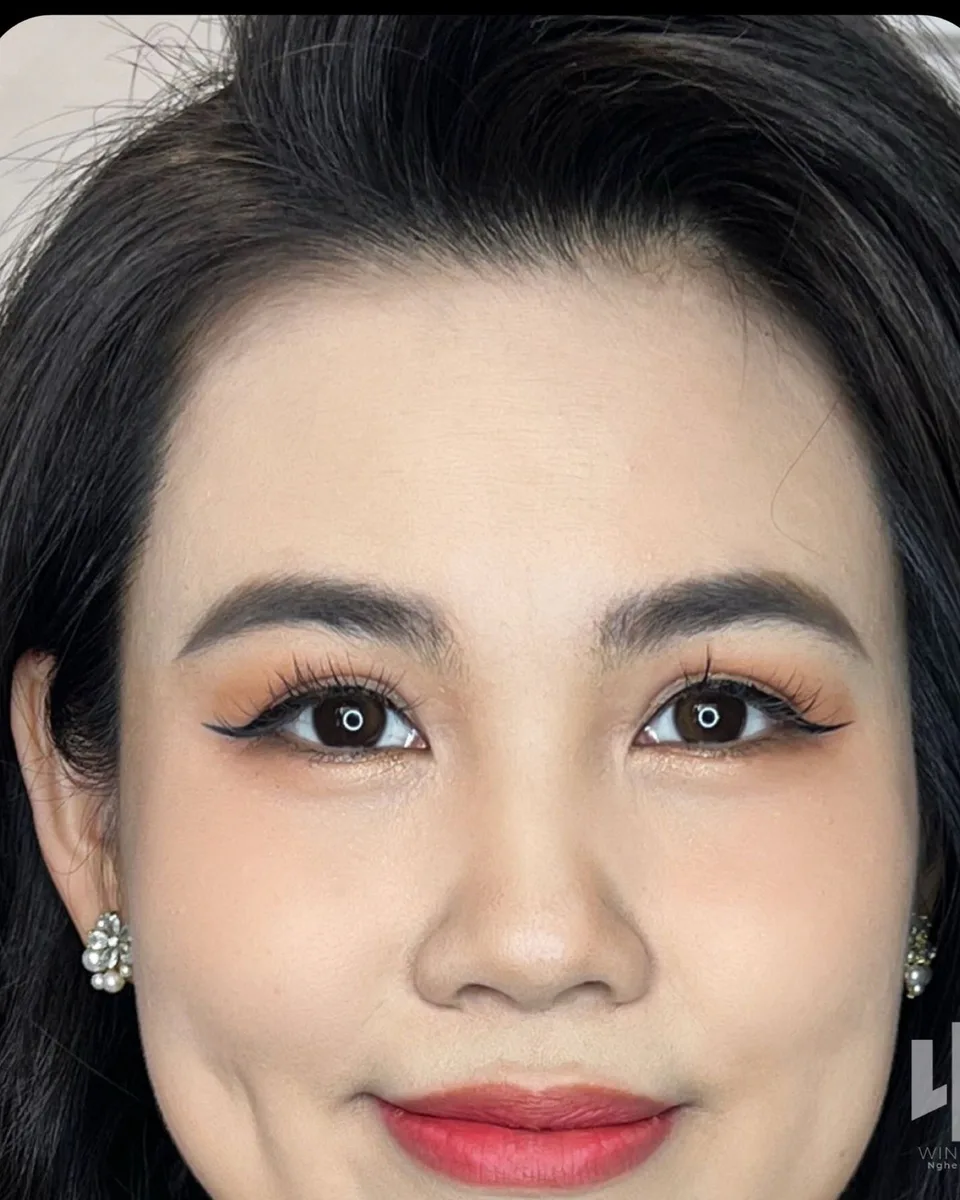 Chân mày kết hợp — Trước