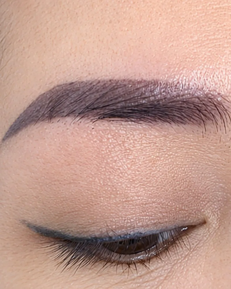 Xóa xăm chân mày bằng laser — Trước